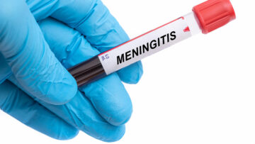 Medizinischer Notfall Meningitis